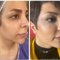 تخفیف مشاوره خدمات زیبایی وجراحی صورت  بدن|خدمات آرایشگری و زیبایی|تهران, میدان ولیعصر|دیوار