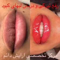 تخفیف ویژه و استثنایی محدودفقط برای ۳ نفر اول