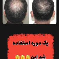 روتین روغن مو عراقی ارگان رزماری بنت السلطان سرشور|آرایشی، بهداشتی، درمانی|مشهد, خواجه ربیع|دیوار