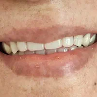 دندانسازی بانو دنت.با چک|خدمات آرایشگری و زیبایی|تربت‌حیدریه, داروپخش|دیوار