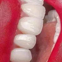 خدمات دندانپزشکی|خدمات آرایشگری و زیبایی|تهران, کوهسار|دیوار