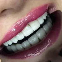 جویایه کار برایه کارورزی دستیار دندانپزشک