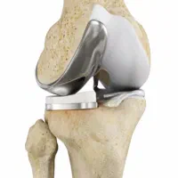 تعویض مفصل-پروتز آمریکایی-تعداد محدود آمریکایی