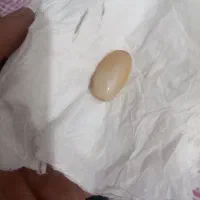 مهره زیرخاکی واسه زن شیرده شرطی