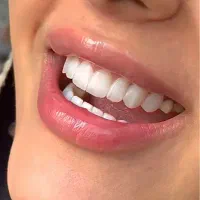 کامپوزیت دندان با بهترین مواد و متریال|خدمات زیبایی و سلامت|کرج, شاهینویلا|دیوار
