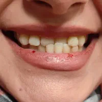 ارتودنسی،لمینت،ایمپلنت،زیبایی،درمانی