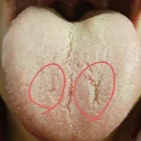 درمانگری با علم زبانشناسی