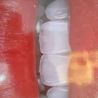 دستیار و منشی دندانپزشکی