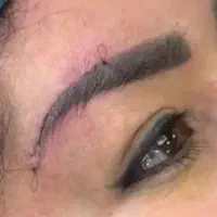 ساکشن و تزریق چربی جراحی و کاشت مووابردرمطب پزشک