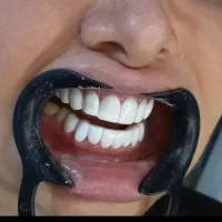 استخدام ویزیتور و بازاریاب کامپوزیت دندان|استخدام بازاریابی و فروش|یاسوج, |دیوار