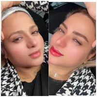میکروبلیدینگ نچرال،شیدینگ لب  «۶۰درصد تخفیف»