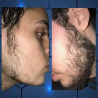 ریشی که همیشه دوست داشتی، شاید دور از دسترس نباشه