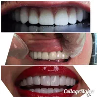 خدمات دندانپزشکی و دندانسازی مستر دِنت|خدمات آرایشگری و زیبایی|ارومیه, |دیوار