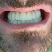 لابراتوار دندانسازی ایمپلنت تخصصی|خدمات آرایشگری و زیبایی|تهران, توحید|دیوار