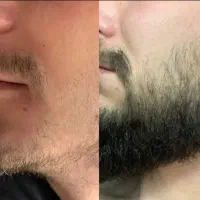 این آخرین روشیه که امتحان میکنی