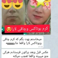 کرم بوتاکس و چاقی صورت لارا|آرایشی، بهداشتی، درمانی|مرودشت, ثبت احوال|دیوار