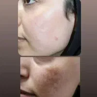 سفیدکنندگی