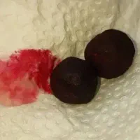 سنگ هبهاب خونی. سنگ جذب