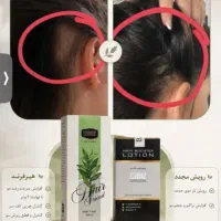 تونیک هیرفرند
