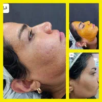 فشیال و خدمات جوانسازی ارغوان بر پایه علم نوین|خدمات آرایشگری و زیبایی|نیشابور, محله میدان باغات|دیوار