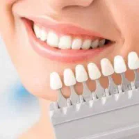 آموزش زیبایی دندان