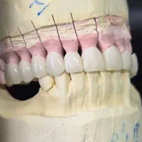 لابراتوار تخصصی دندانسازی آرتمیس