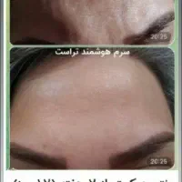 زیبایی پوستی محصولات مراقبتی|آرایشی، بهداشتی، درمانی|رباط‌کریم, شهرستانک|دیوار