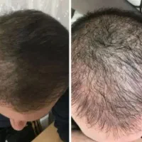 به سبک گیاهی رویش انجام میشه