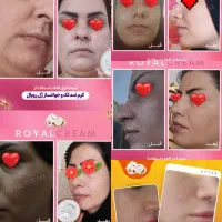 پنکک لاکچری کوین اصل