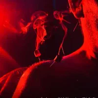 آموزش حجامت طب سنتی و طب سوزنی