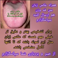 تشخیص بیماری‌ها از روی عکس زبان کاملا رایگان|خدمات آرایشگری و زیبایی|مشهد, فارغ التحصیلان|دیوار