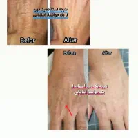 کرم سفت کننده تخصصی گاتیو|آرایشی، بهداشتی، درمانی|باسمنج, |دیوار