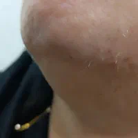 الکترولیز موی سفید وبرداشتن خال و زگیل ومیخچه|خدمات آرایشگری و زیبایی|یاسوج, |دیوار