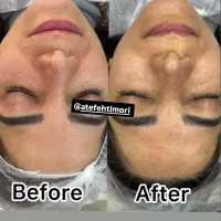 فیشیال تخصصی تربت جام