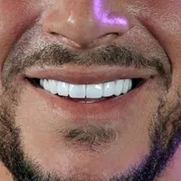 خدمات لمینیت و کامپوزیت دندان و پروتزهای دندانی|خدمات آرایشگری و زیبایی|کرج, گلشهر|دیوار