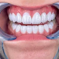 کامپوزیت نچرال و لبه شیشه ای+خدمات رایگان/اقساط|خدمات آرایشگری و زیبایی|تهران, تجریش|دیوار