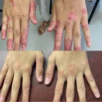 درمان قطعی و بدون بازگشت مشکلات پوستی|خدمات آرایشگری و زیبایی|مشهد, کلاهدوز|دیوار