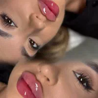 تزریق ژل و بوتاکس با قیمت ویژه و کیفیت تضمینی