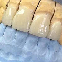 دستیار دندانپزشک