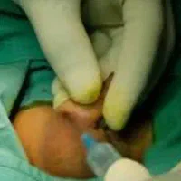 خدمات زیبایی و ختنه