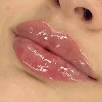 تزریق ژل و بوتاکس