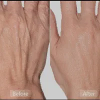 خدمات تخصصی پوست و مو در کلینیک فرسیما