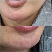 تخفیفات زیبایی