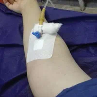 پزشک پرستار تزریقات سرم سوند در منزل شبانه روزی|خدمات آرایشگری و زیبایی|تبریز, |دیوار