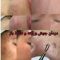 انجام خدمات پوستی هم بانوان و اقایان|خدمات آرایشگری و زیبایی|گرگان, |دیوار