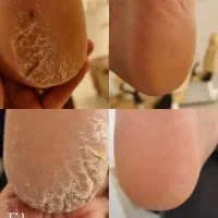 خدمات کفسابی و پدیکور