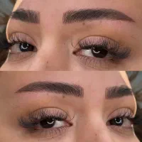 میکروبلیدینگ(فیبروز)