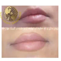 کلینیک لیزر پوست،مو جهانطلا در کرمانشاه (فوتونا)|خدمات آرایشگری و زیبایی|کرمانشاه, |دیوار