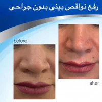مرکز مراقبت پوست مو لاغری رشت|خدمات آرایشگری و زیبایی|رشت, گلباغ نماز|دیوار
