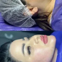 مرکزلیپوساکشن‌ و ساکشن غبغب و زاویه سازی توسط جراح